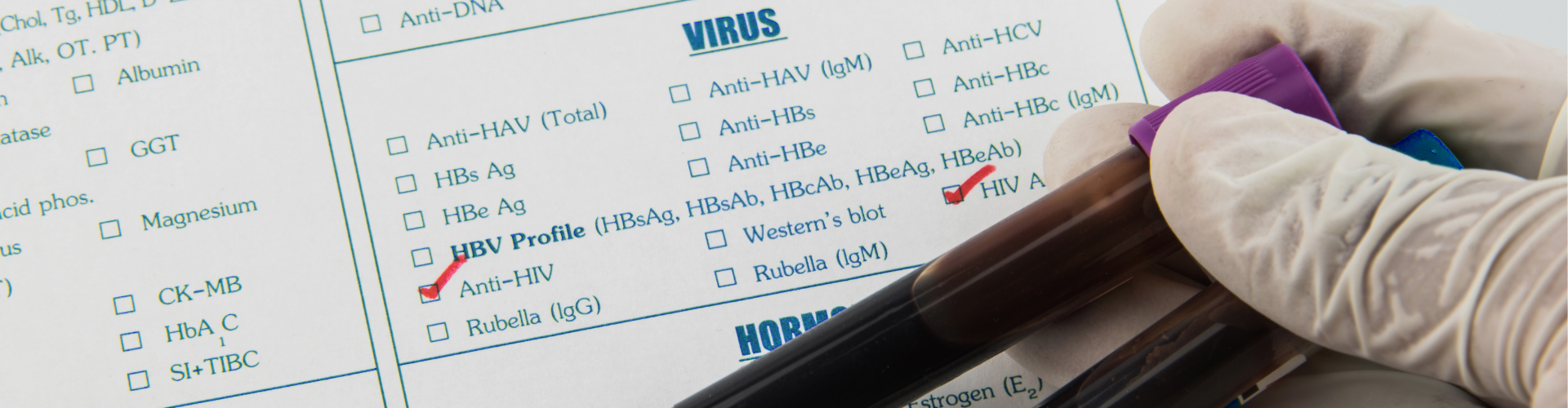 Meet Desa Lilic, Expert Witness in Clinical Immunology