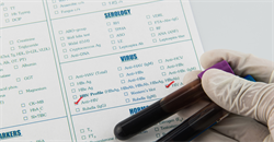 Meet Desa Lilic, Expert Witness in Clinical Immunology