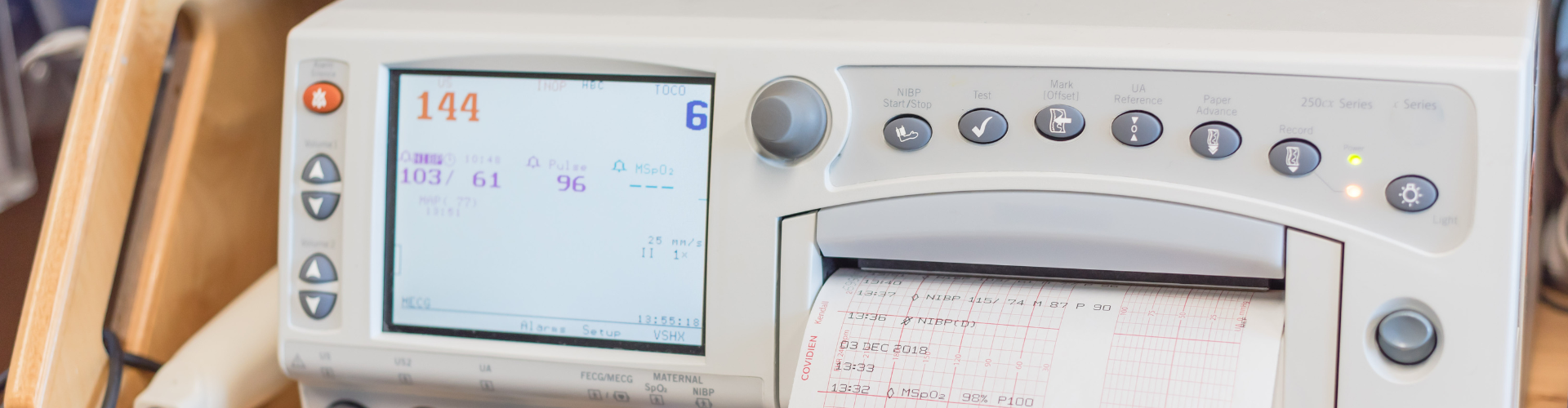 Cardiotocograph – normal or abnormal