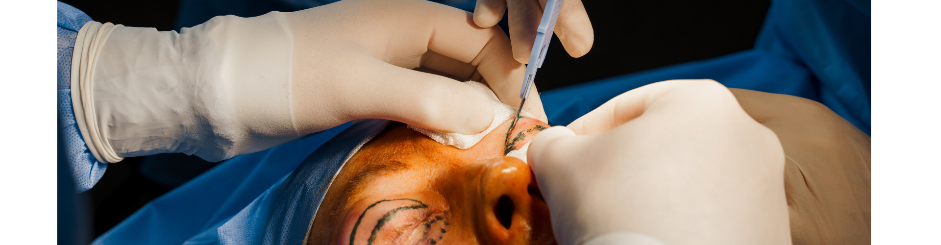 A Day in the Life of a Plastic, Aesthetic and Hair transplant Surgeon and Expert Witness