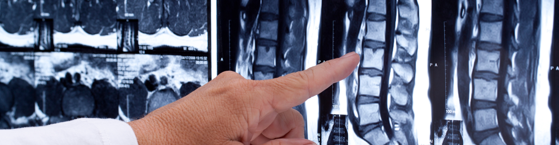 Rebecca Hepworth v Dr Amanda Coates [2025] EWHC 1907 (KB)